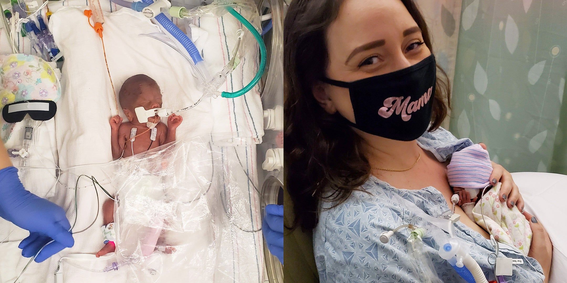Premature baby Gracie in an incubator, Mother Britni holding baby Gracie
