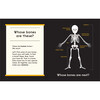 Whose Bones - Books - 3