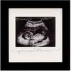 SOLO Baby Sonogram Frame, Onyx Black - Frames - 1 - thumbnail