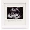 Baby Sonogram Frame, Alpine White - Frames - 1 - thumbnail