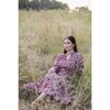 Elizabeth Midi - Dresses - 3