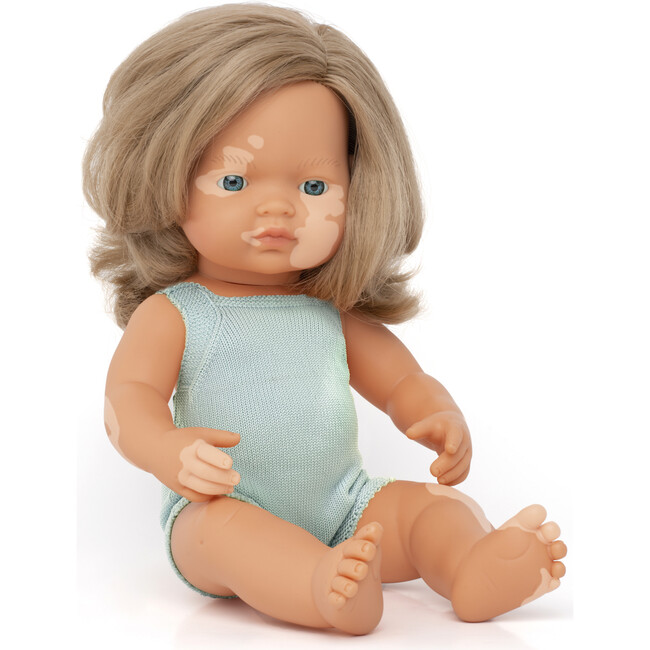 Colourful Edition Collection - Baby Doll Caucasian Dirty Blonde Girl with Vitiligo 15''